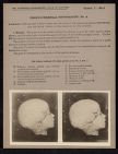 Cranio-Cerebral Topography - no. 4